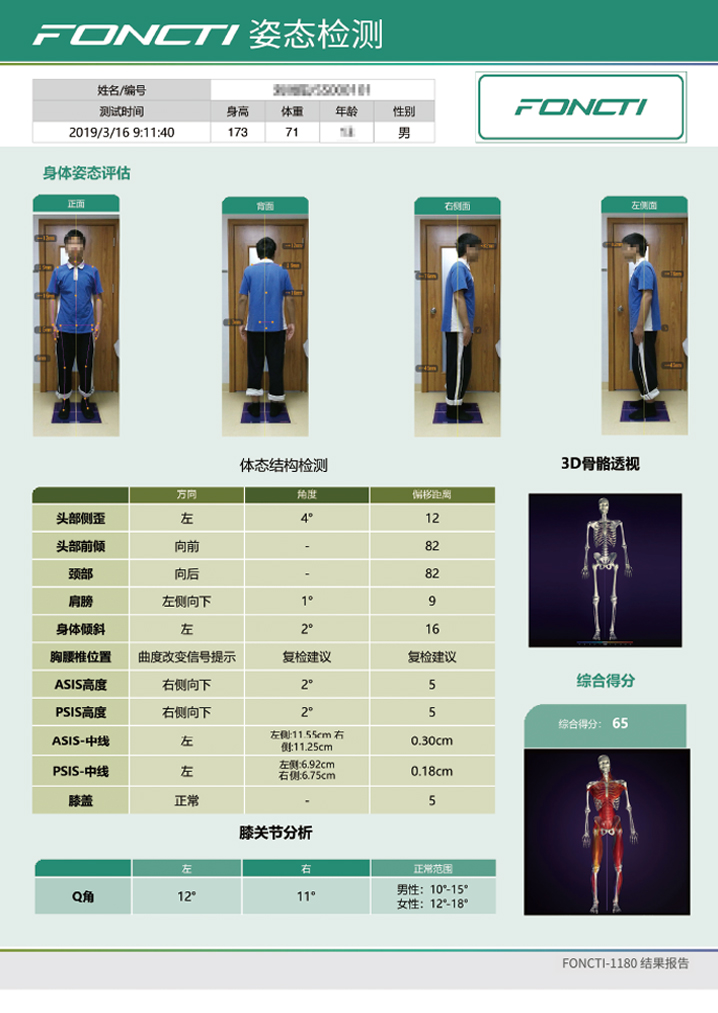 步態(tài)分析系統(tǒng)產(chǎn)品報(bào)告