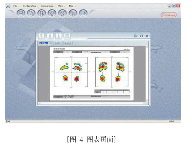 足底壓力分析儀