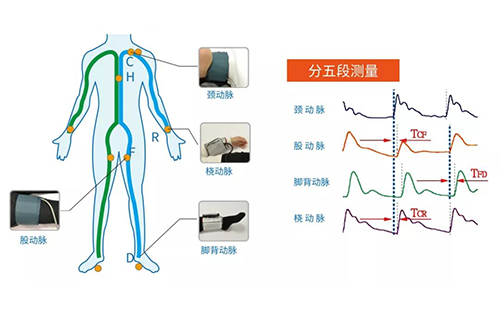 動脈硬化檢測儀