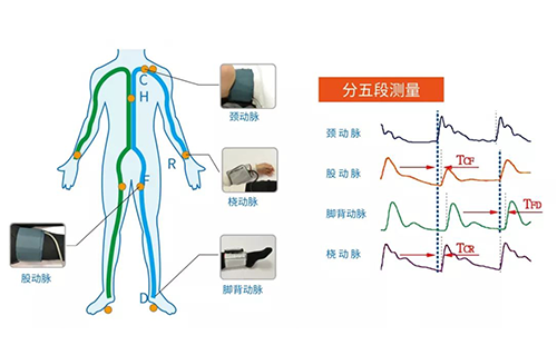 動脈硬化分析儀